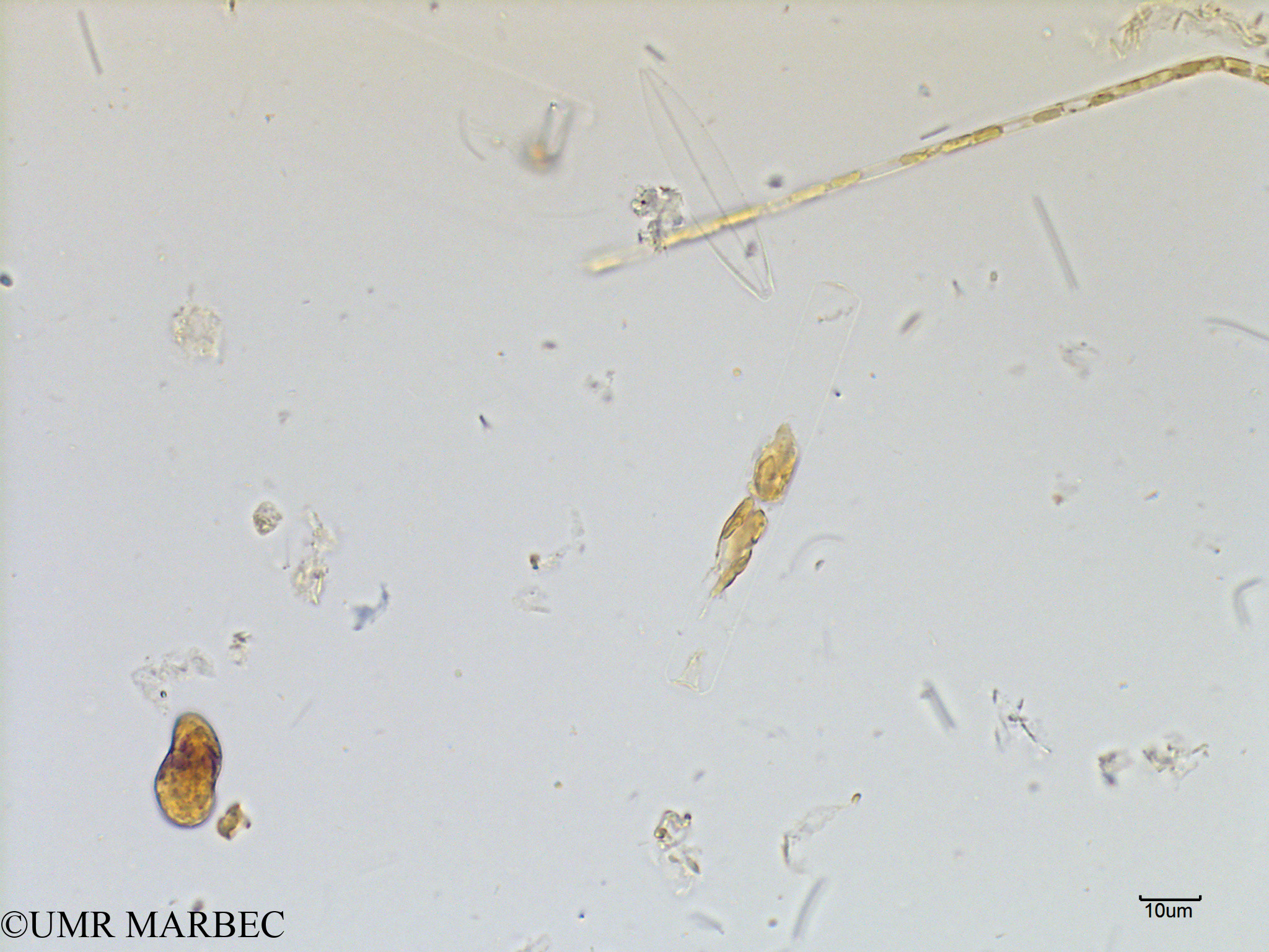 phyto/Scattered_Islands/mayotte_lagoon/SIREME May 2016/Cerataulina pelagica (MAY7_cerataulina-4).tif(copy).jpg